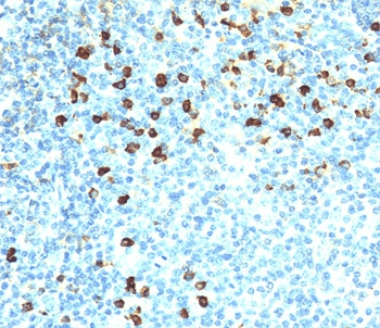 Mouse Anti-Human Kappa Light Chain Secondary Antibody (clone KLC264, Ready-to-Use)