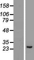 GPX8 Protein (Over-Expression Lysate Myc-DDK (Flag))