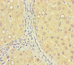 ZNF583 Antibody