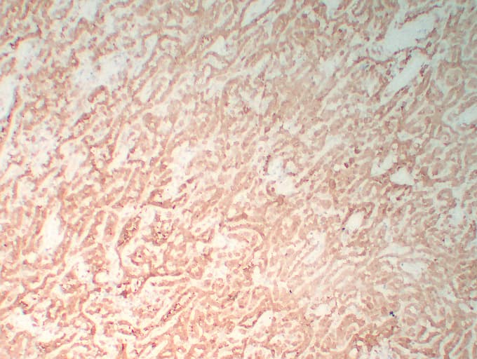 CALB2 / Calretinin Antibody (clone ABT-Calret 1)