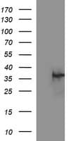 Monoclonal Mouse anti-Human EPCAM Antibody (clone OTI2B8, IF, WB)
