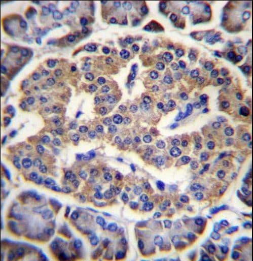 Polyclonal Rabbit anti-Human EIF4H Antibody (aa127-156, IHC, WB)
