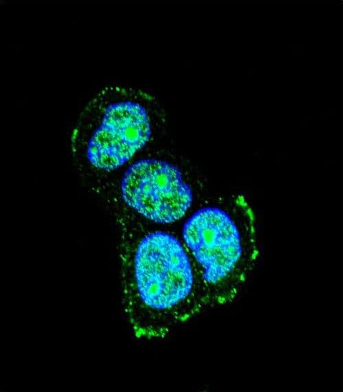 IHC-plus™ Polyclonal Rabbit anti-Human MAPK8IP1 / JIP1 Antibody (aa470-498, IHC, IF, WB)