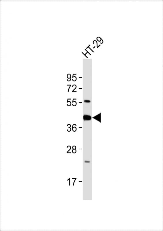 Polyclonal Rabbit anti-Human GNAI3 Antibody (aa309-343, WB)