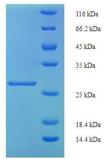 Human INHBA / Inhibin Beta A Protein (Recombinant His-SUMO)