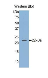 GBA / Glucosidase Beta Acid Antibody (aa334-498, Biotin)