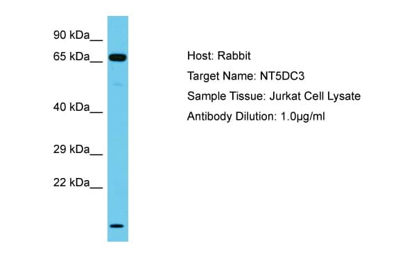 Polyclonal Rabbit anti-Human NT5DC3 Antibody (aa437-486, WB)