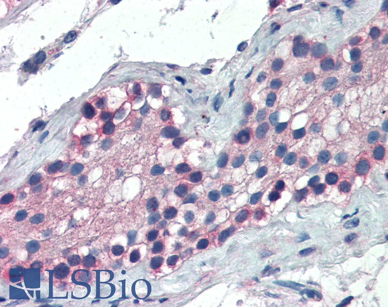 IHC-plus™ FOXE2 / FOXE1 Antibody (aa361-373)