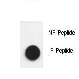 Polyclonal Rabbit anti-Human NPHS1 / Nephrin Antibody (phospho-Tyr1193)