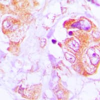 CASP3 / Caspase 3 Antibody (Internal)