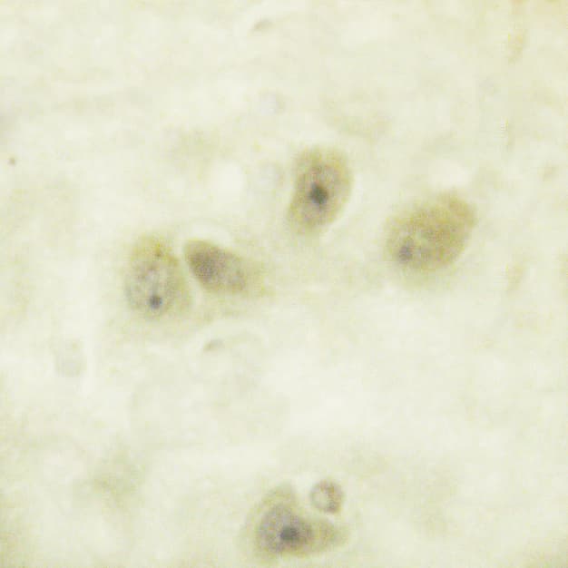 Polyclonal Rabbit anti-Human GFAP Antibody (phospho-Ser38, IHC, IF, WB)
