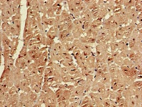 EMD / Emerin Antibody