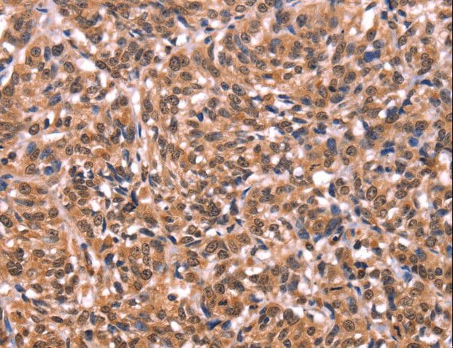 ESRRB / ERR Beta Antibody