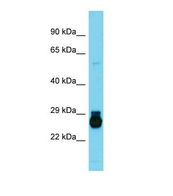 Polyclonal Rabbit anti-Rat HOXC6 Antibody (aa103-152, WB)