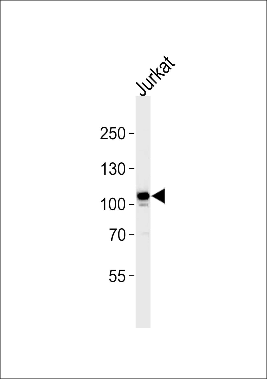 MER / MERTK Antibody