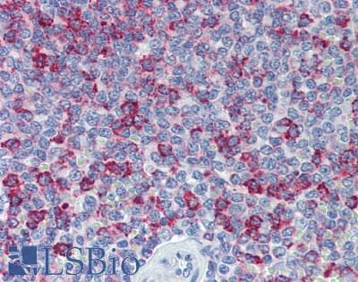 IHC-plus™ HVCN1 / HV1 Antibody