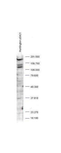 IHC-plus™ HTT / Huntingtin Antibody (phospho-Ser421)