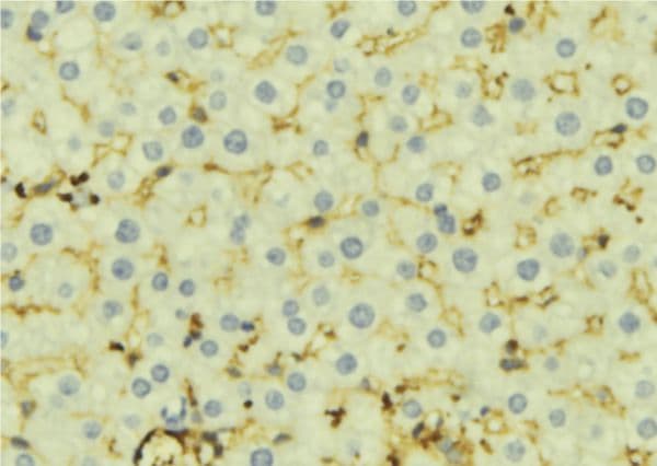 Carboxylesterase 1 / CES1 Antibody