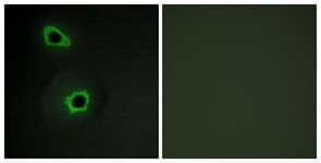 IHC-plus™ COL7A1 / Collagen VII Antibody (aa1841-1890)