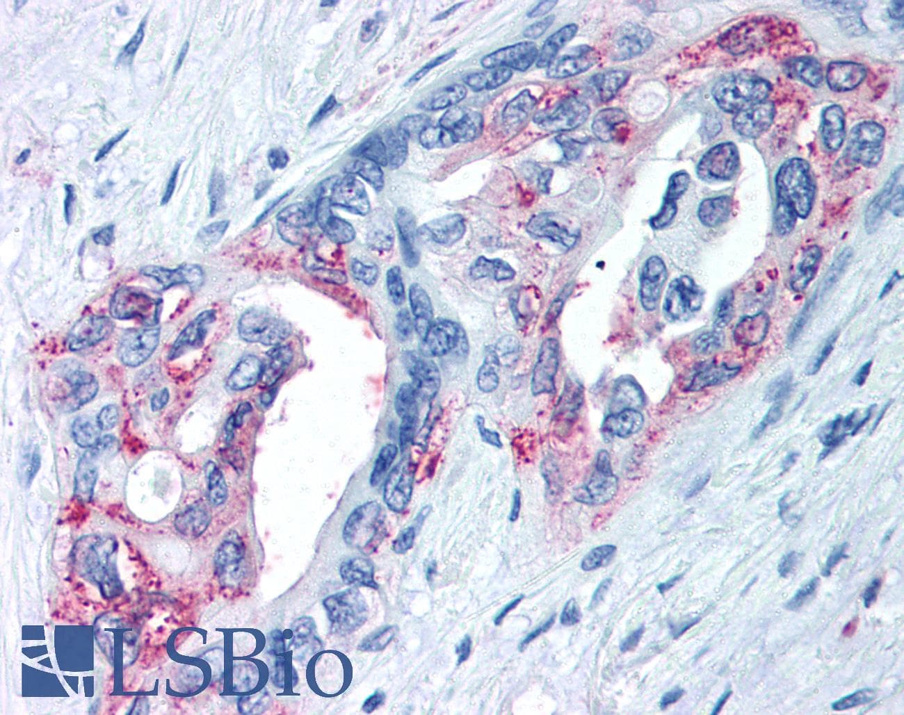 PathPlus™ TRPM8 Antibody (Internal)