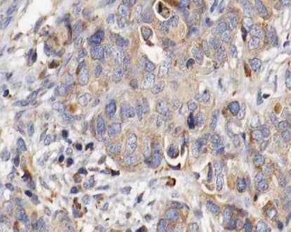 Polyclonal Rabbit anti-Human FBN1 / Fibrillin 1 Antibody (IHC, IF, WB)