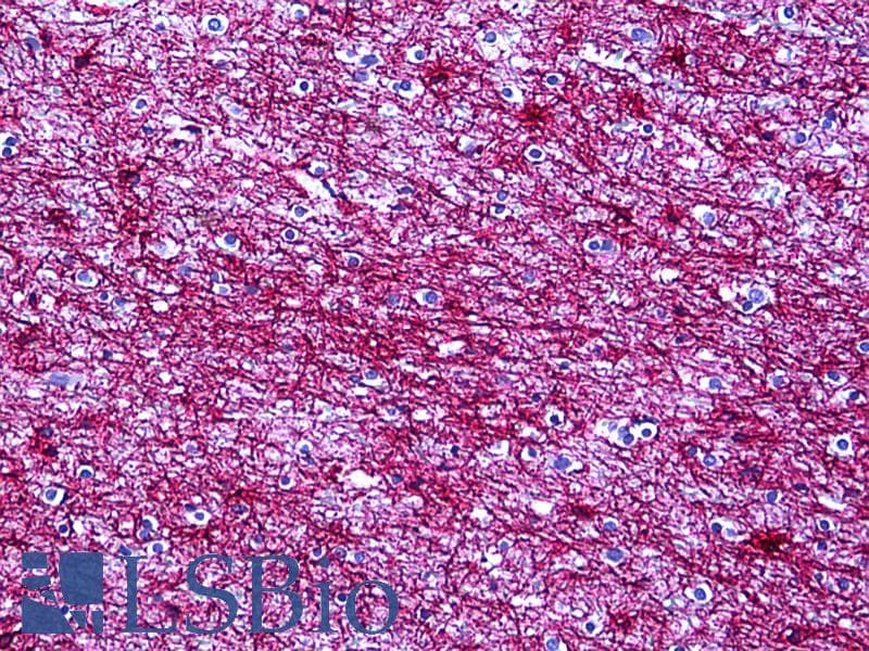PathPlus™ GFAP Antibody (clone GFA-02)