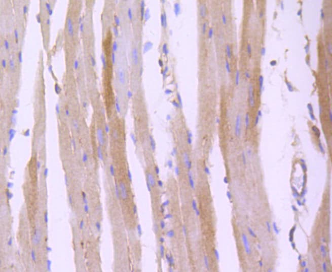 Rho Kinase / ROCK1 Antibody