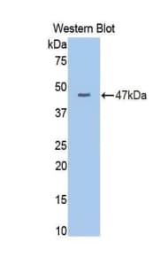 Polyclonal Rabbit anti-Human Complement C3 Antibody (aa1322-1661, WB)