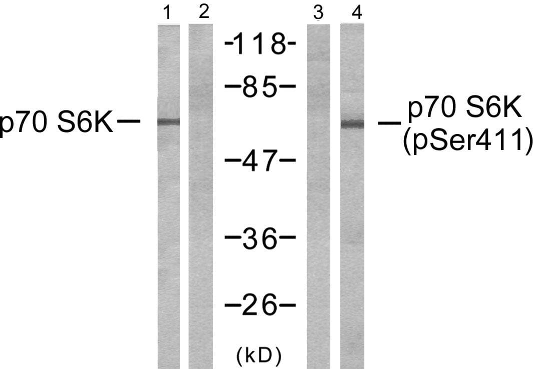 RPS6KB1 / P70S6K / S6K Antibody (phospho-Ser411)