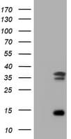 TS / Thymidylate Synthase Antibody (clone OTI1A6)