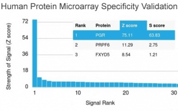 Monoclonal Mouse anti-Human PR / Progesterone Receptor Antibody (clone PGR/2694, Ready-to-Use, IHC)