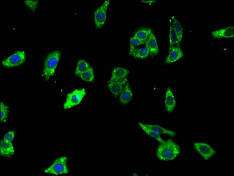 Polyclonal Rabbit anti-Human KIAA1409 / UNC79 Antibody (IHC, IF)