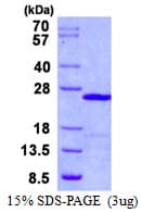 Human UBE2E1 / UBCH6 Protein (Recombinant His)