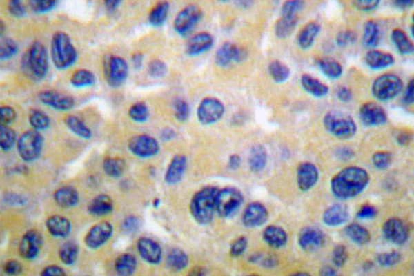 COL2A1 / Collagen II Alpha 1 Antibody (Pro133)