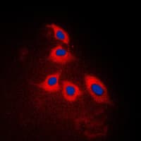 IHC-plus™ ARRDC3 Antibody (C-Terminus)
