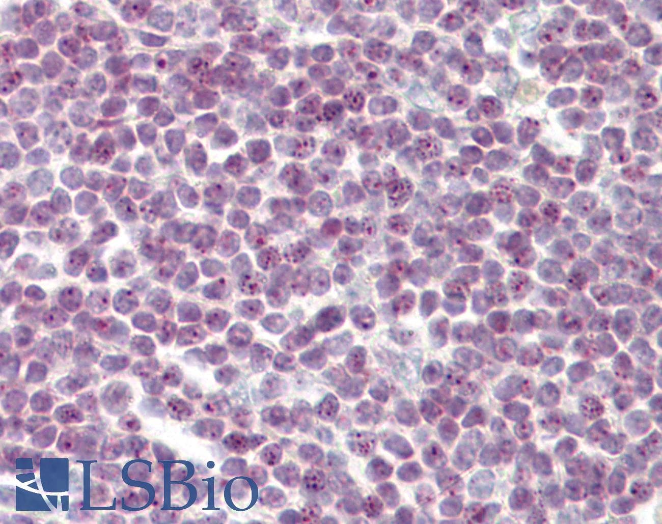 IHC-plus™ URB1 Antibody (aa2013-2062)