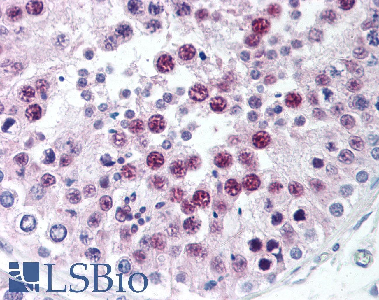 IHC-plus™ SIRT1 / Sirtuin 1 Antibody (C-Terminus)