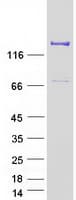 Human AGL Protein (Recombinant Myc-DDK (Flag))