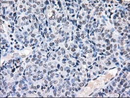 CYPOR / POR Antibody (clone OTI2E4)
