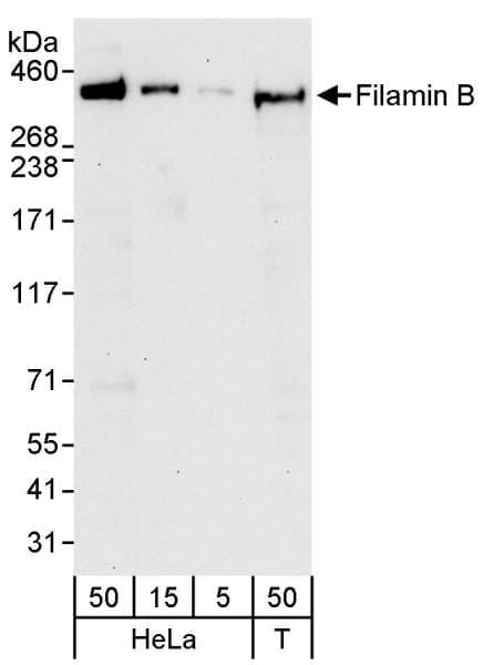 FLNB / TAP Antibody (aa1225-1275)