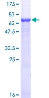 Human GNAS Protein (Recombinant GST)