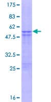 Human STYX Protein (Recombinant GST)