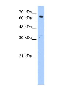Polyclonal Rabbit anti-Human FAR1 Antibody (aa31-80, WB)
