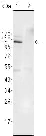 EPHB4 / EPH Receptor B4 Antibody (clone 7H4A6)