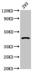 HSD2 / HSD11B2 Antibody