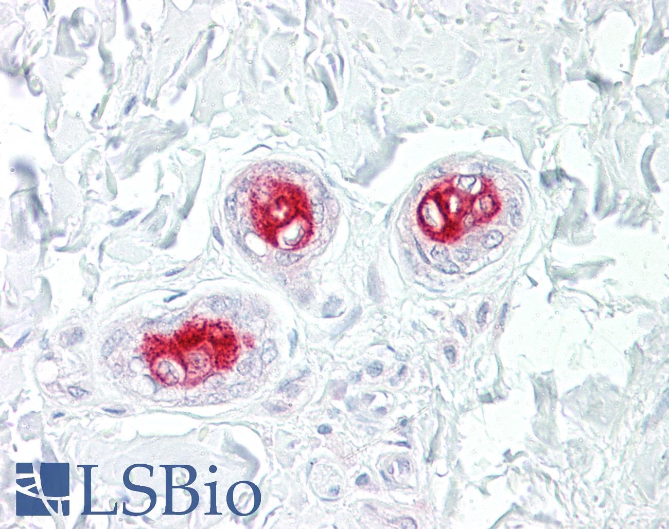 IHC-plus™ MAP3K5 / ASK1 Antibody (aa49-98)