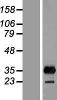 LIN28B Protein (Over-Expression Lysate Myc-DDK (Flag))