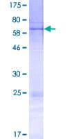 Human FBS1 Protein (Recombinant GST)