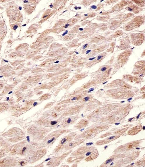 CHRM2 / M2 Antibody (clone 1424CT461.78.60)