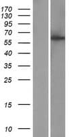 CCDC183 / KIAA1984 Protein (Over-Expression Lysate Myc-DDK (Flag))
